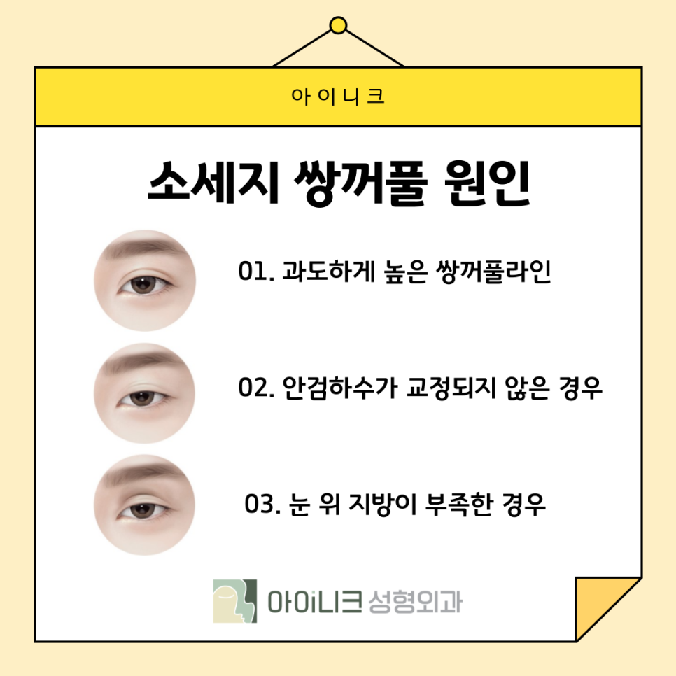 How Can Sausage-Eye Revision Surgery Be Done Naturally? image 5