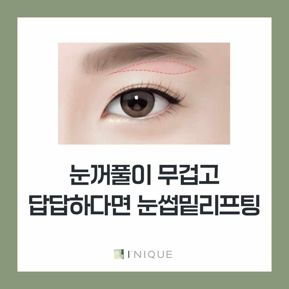 중년 눈성형 잘하는 병원, 하안검과 눈썹밑리프팅 함께봐야하는 이유 관련 이미지 4