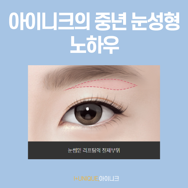 부모님을 위한 눈처짐 수술, 제대로 알고 해요 관련 이미지 3