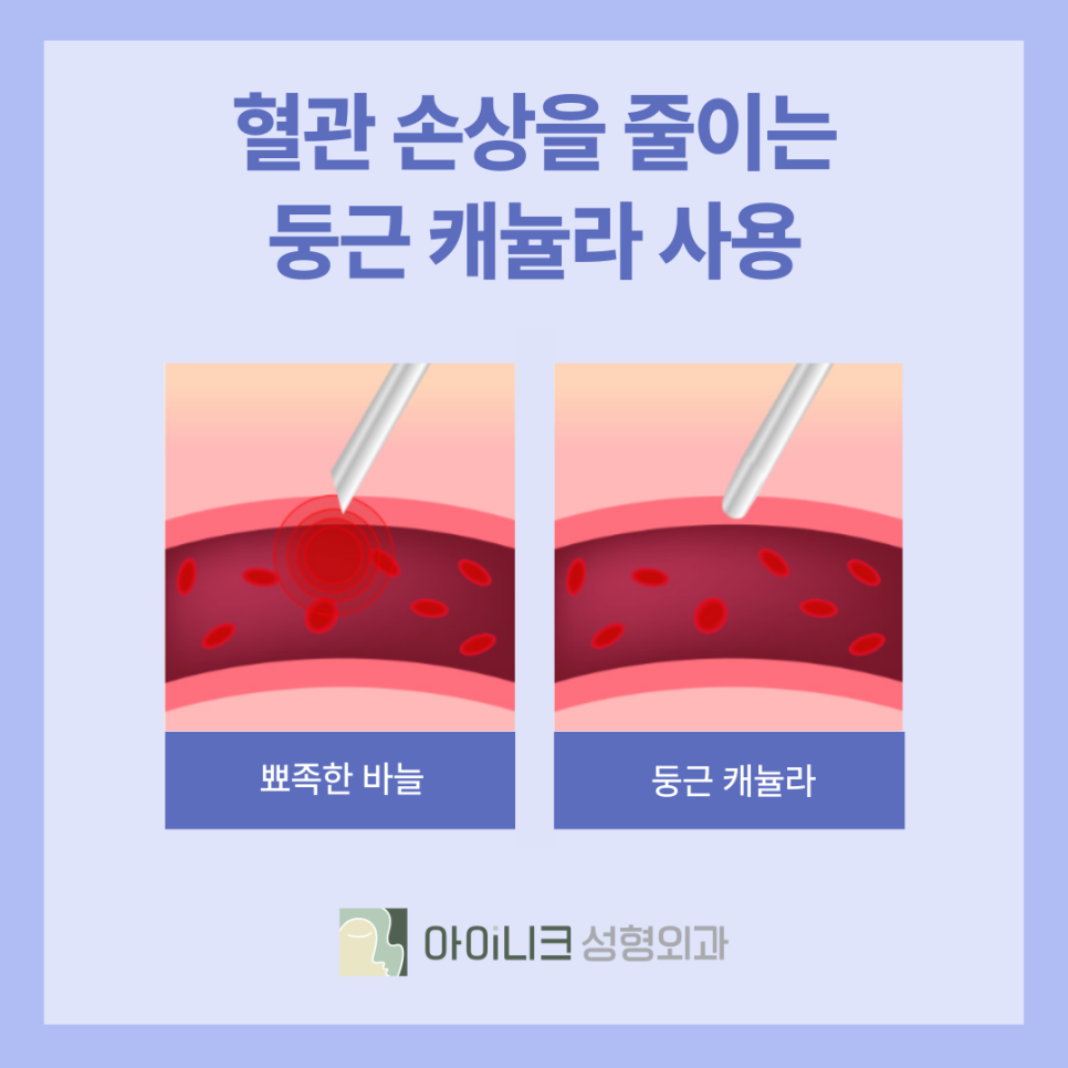 Achieve a Natural Look with Convenient Fillers in Apgujeong image 7