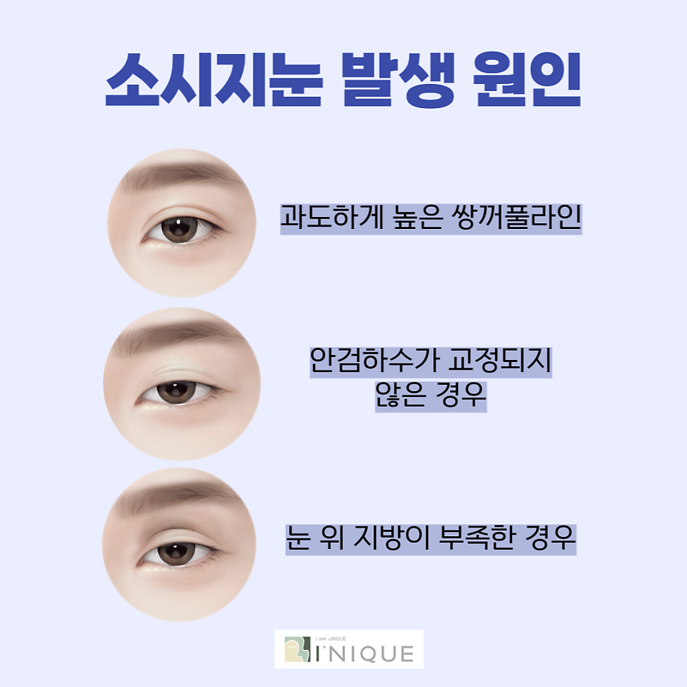 How to Naturally Lower the Double Eyelid Line image 2