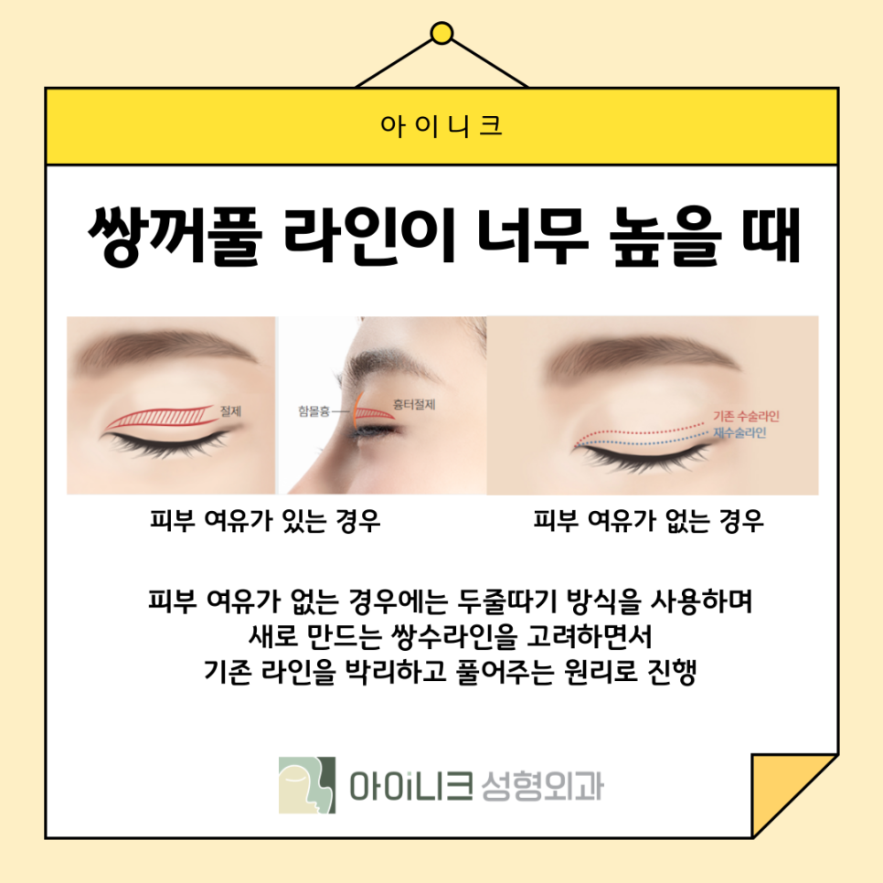 How Can Sausage-Eye Revision Surgery Be Done Naturally? image 7