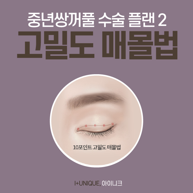 중년 눈 성형? 쌍꺼풀보다 눈썹 밑 리프팅, 하안검 수술 추천 관련 이미지 3