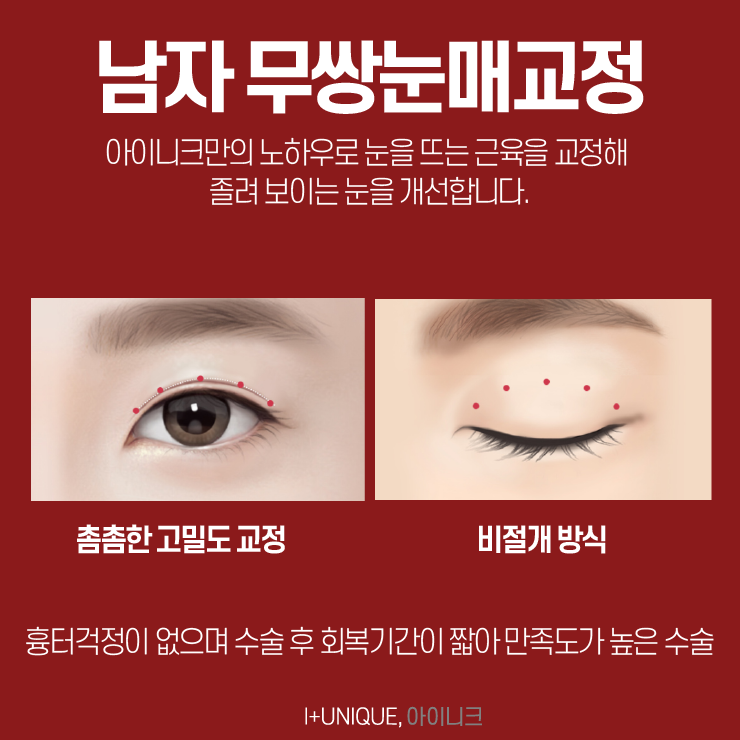남자눈매교정병원 아이니크성형외과에서 알려주는 자연스러운 눈성형방법 관련 이미지 4