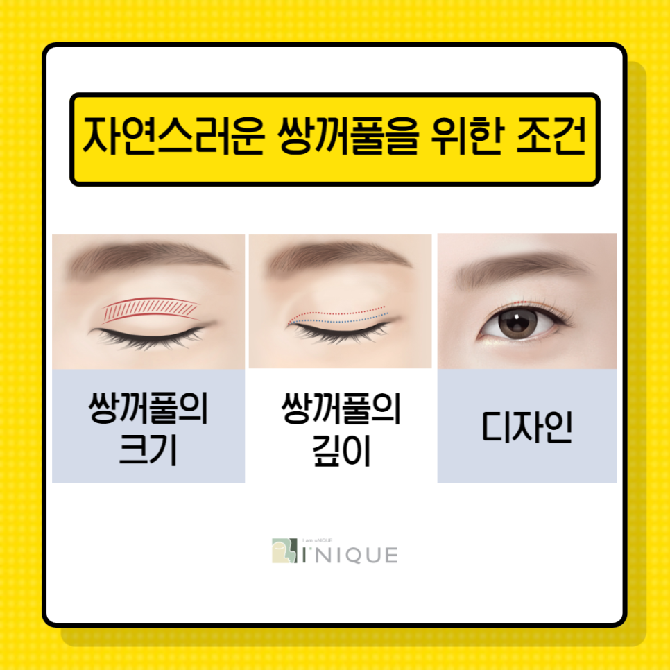 강남쌍수잘하는곳은 뭐가 다를까? 관련 이미지 3