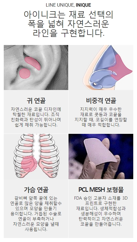 코끝연골묶기가격 정확한 수술로 보답하는 아이니크! 관련 이미지 5