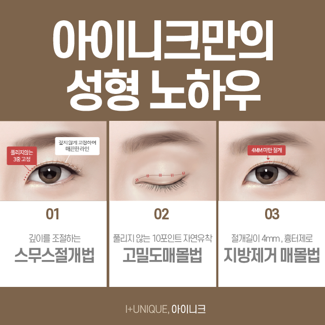 아이니크만의 특별한 쌍꺼풀수술방법 공개! 관련 이미지 2