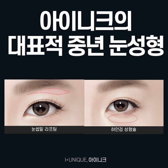 Eyebrow Lift and Lower Blepharoplasty: Back to Your 20s! image 2