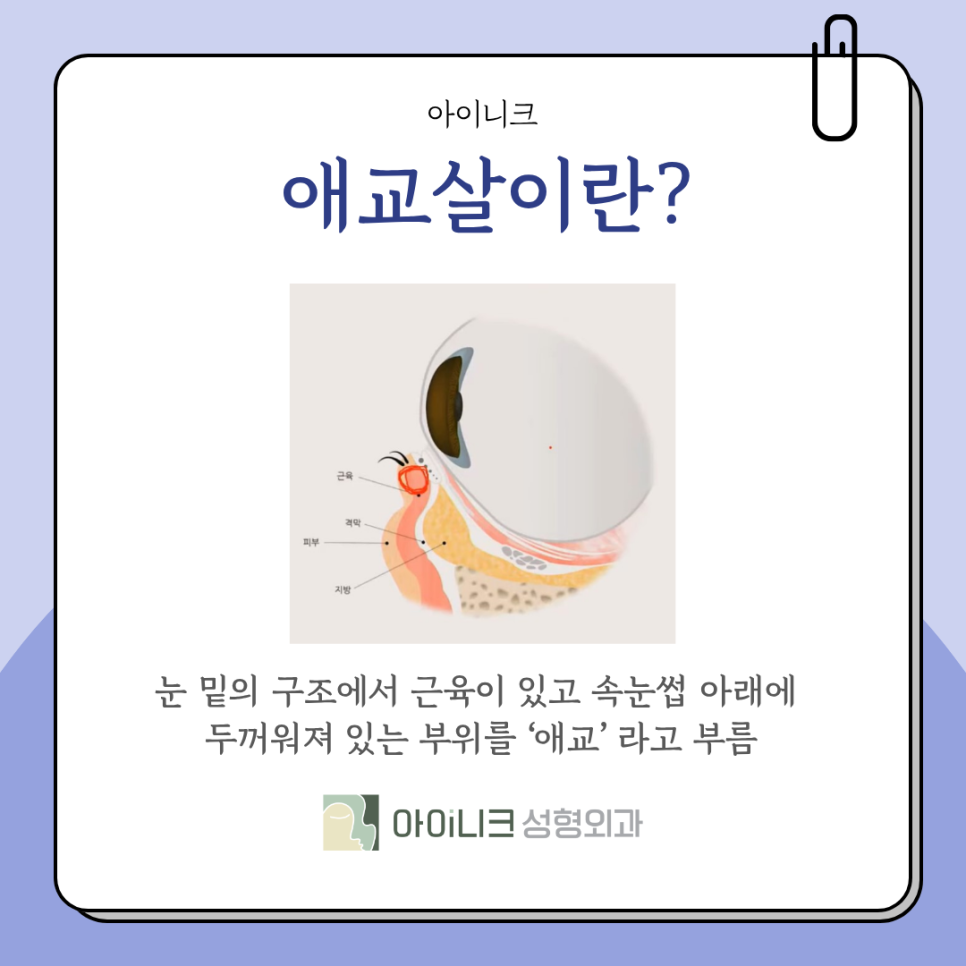 Best Place for Under-Eye Fat Repositioning: Answers to Questions About Under-Eye Surgery image 3