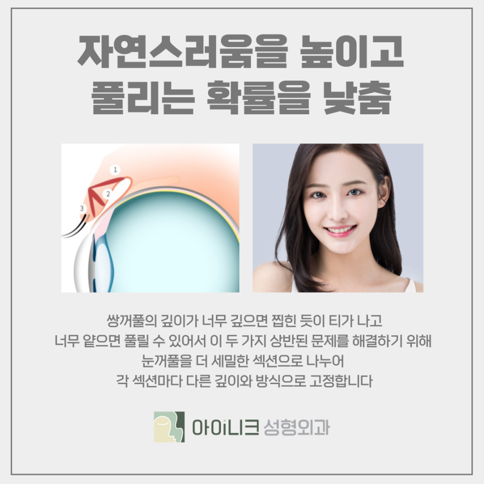 압구정 쌍꺼풀 라인 디자인 개인의 타고난 피부결에 따라 관련 이미지 4