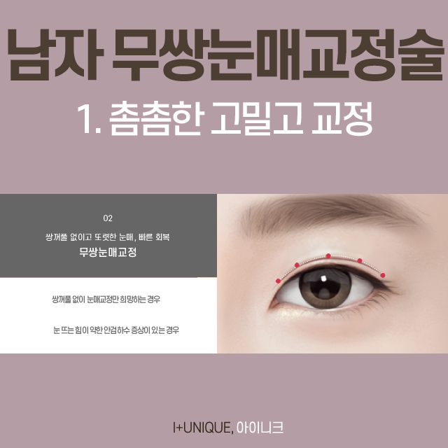 쌍꺼풀 없이도 또렷한 눈매를 원한다면 무쌍눈매교정술! 관련 이미지 5