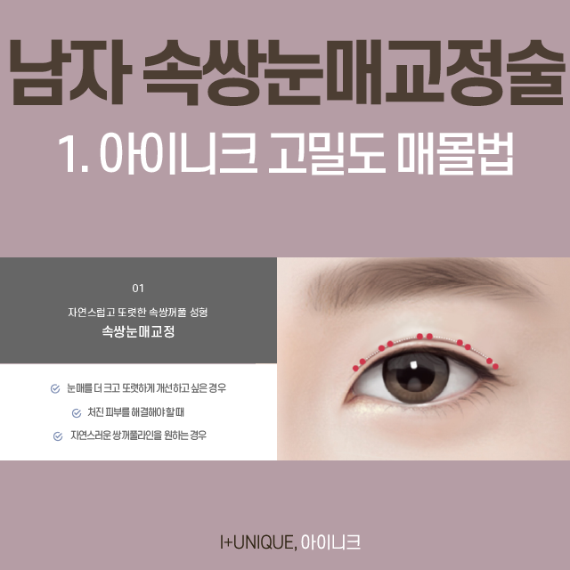 쌍꺼풀 없이도 또렷한 눈매를 원한다면 무쌍눈매교정술! 관련 이미지 2