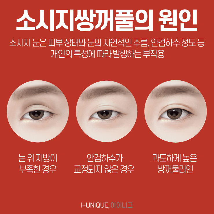 유명한 눈재수술명의를 찾고 있다면 아이니크성형외과로 관련 이미지 3