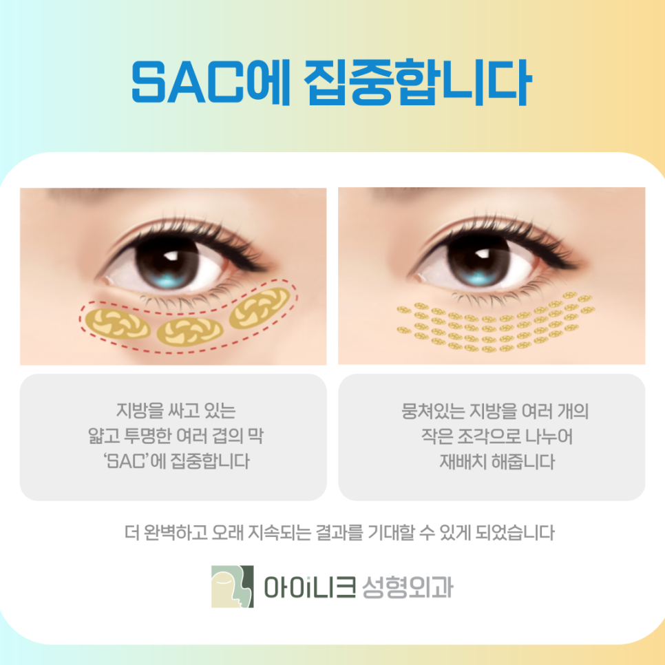 Recommended Hospital for Under-Eye Fat Repositioning: Improving with Aineek image 6