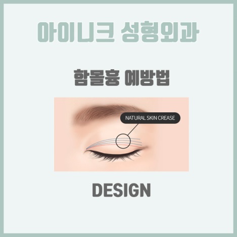 쌍커플재수술비용 원인별 맞춤 솔루션 제공! 관련 이미지 10
