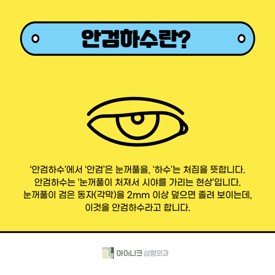 눈매교정잘하는곳에서 졸린 눈 해결 후기 관련 이미지 2