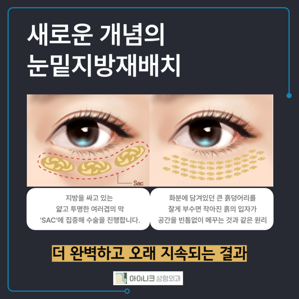 눈밑에주름 확실하게 개선하는 방법 관련 이미지 3