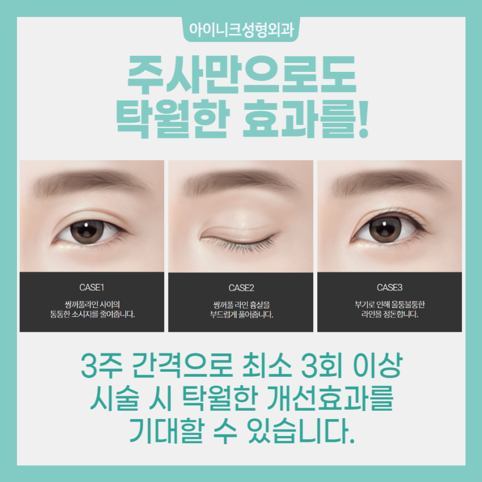 쌍꺼풀 붓기 도움을 원한다면? 관련 이미지 5