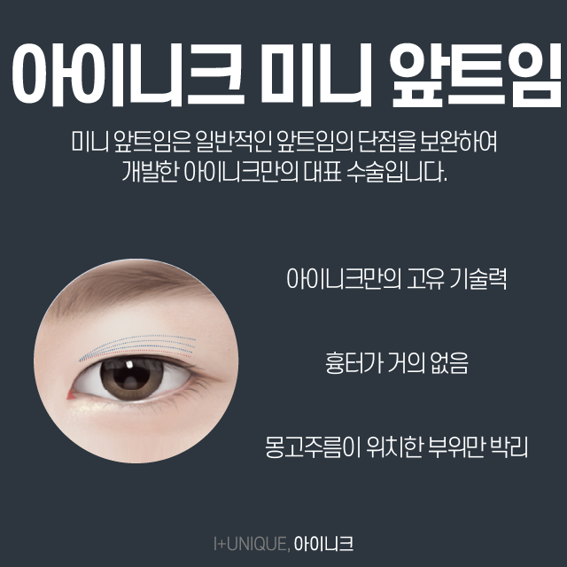 몽고주름앞트임 여기로 결정하자. 관련 이미지 3