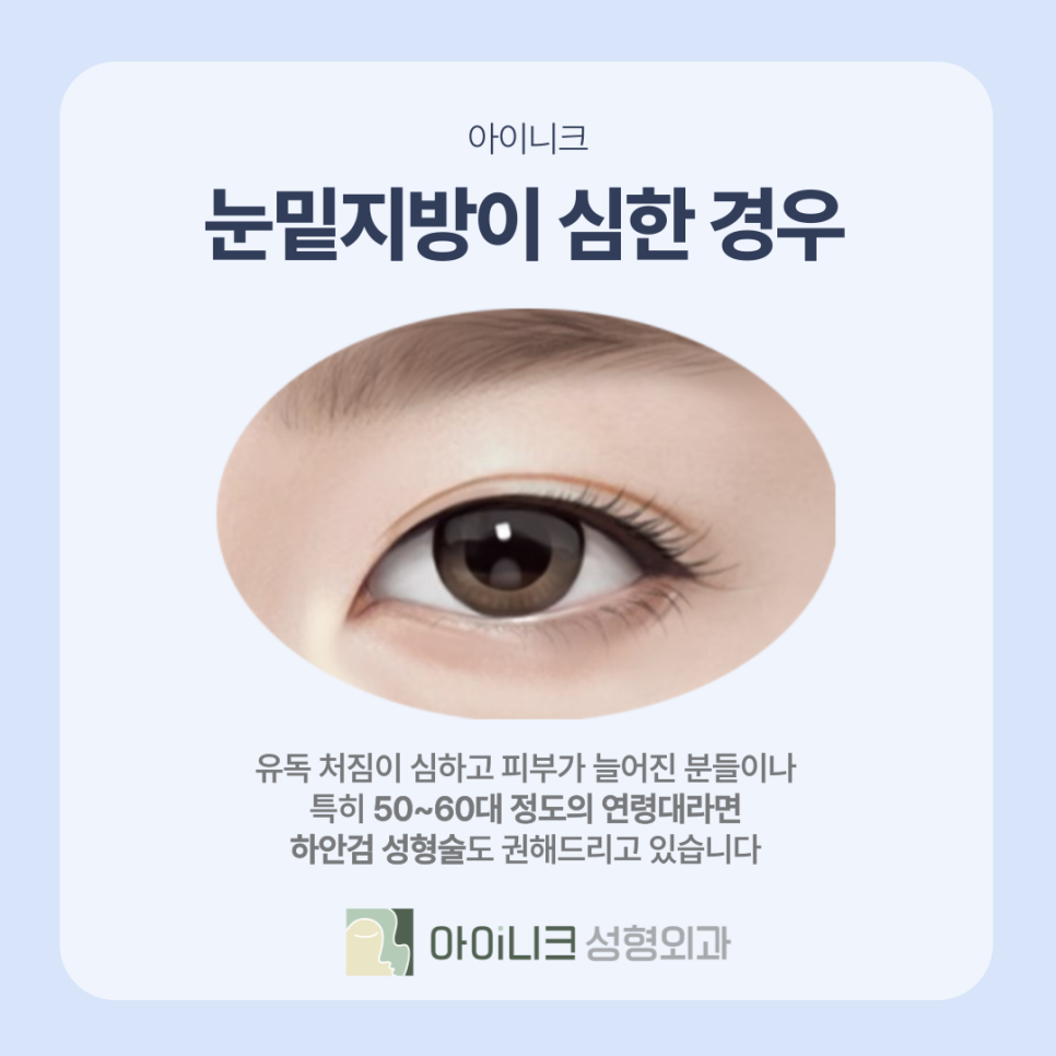 SAC를 중심으로 하는 눈밑지방제거병원의 방식은? 관련 이미지 7