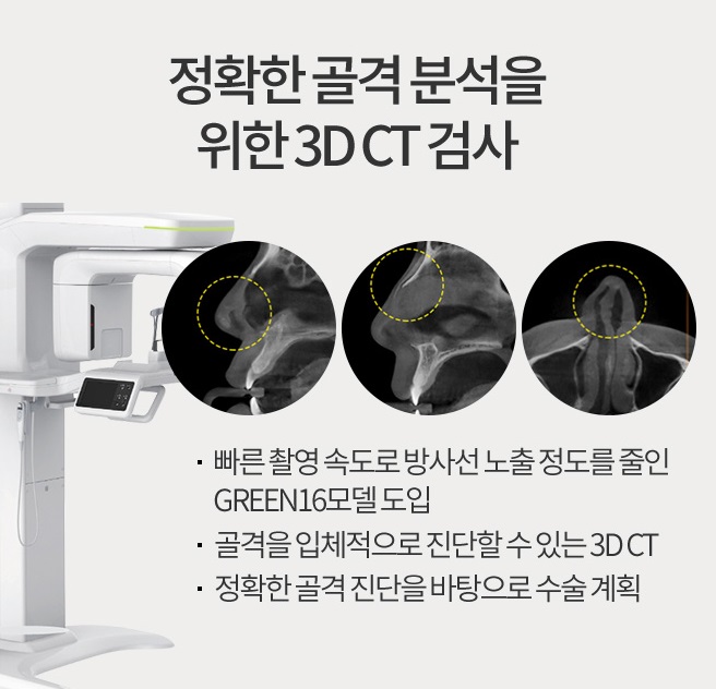코재건수술 두 번의 실수는 없다! 관련 이미지 9