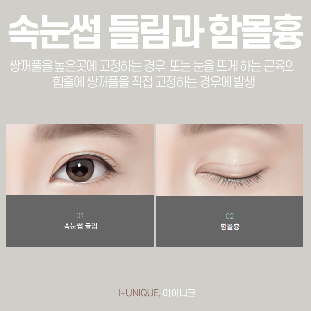 속눈썹들림으로 속상한 내 눈, 어떻게 되돌릴 수 있을까? 관련 이미지 2