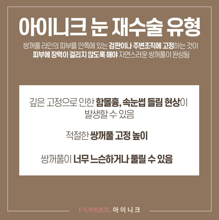 눈재수술을 원한다면 아이니크성형외과에서 확실하게 관련 이미지 4