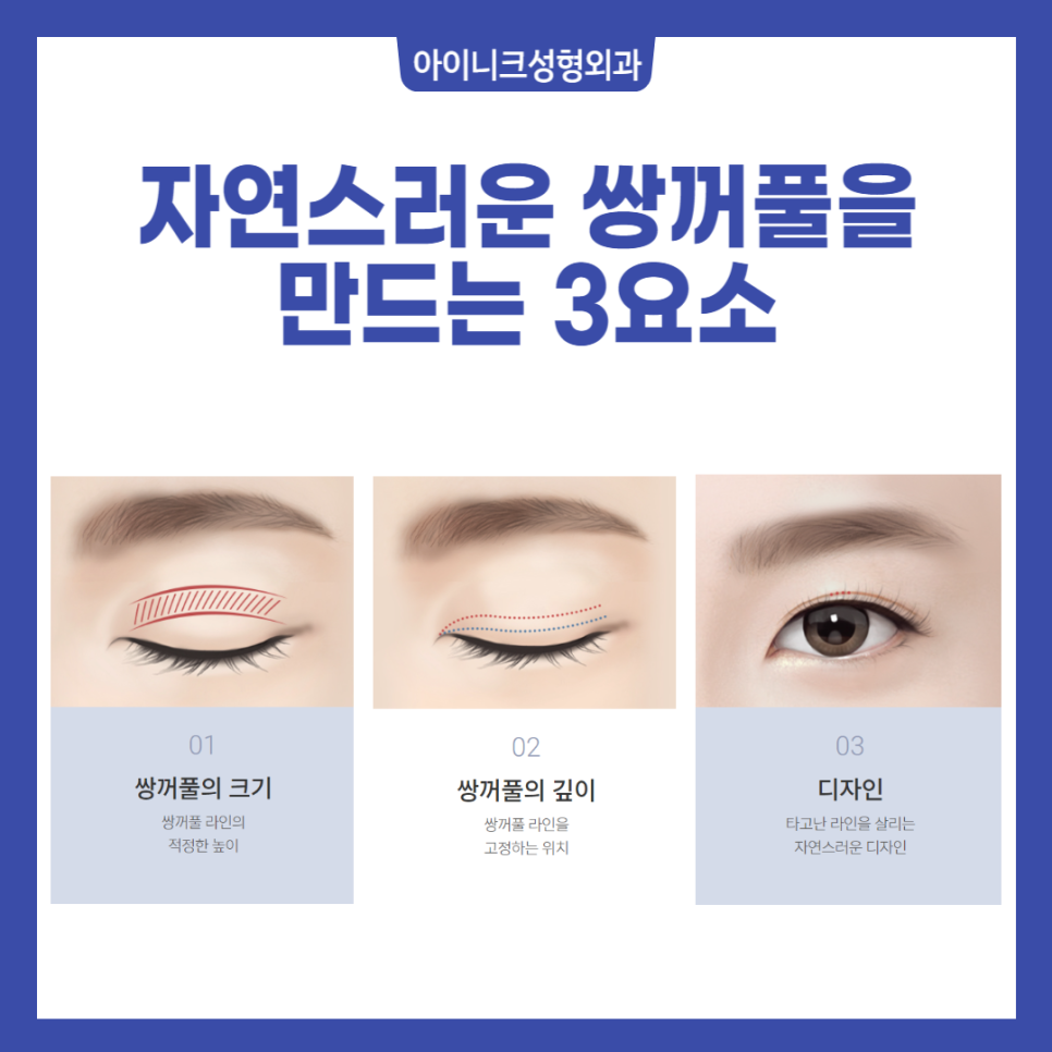 What Is More Important Than the Cost of Double Eyelid Surgery? image 3