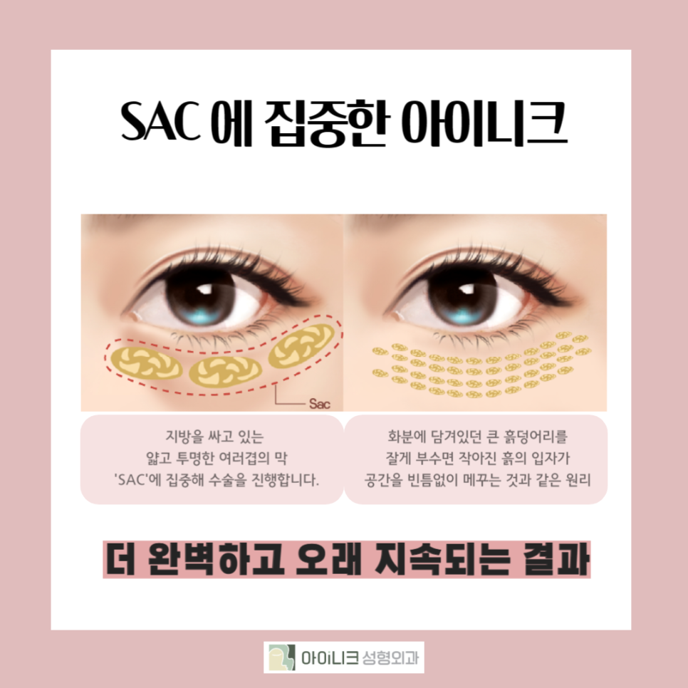 눈밑지방재배치잘하는병원을 찾고계시나요? 관련 이미지 2