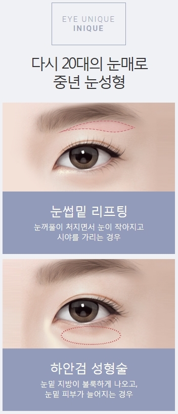 하안검수술가격 합리적인 아이니크에서 동안 얼굴로 개선! 관련 이미지 2