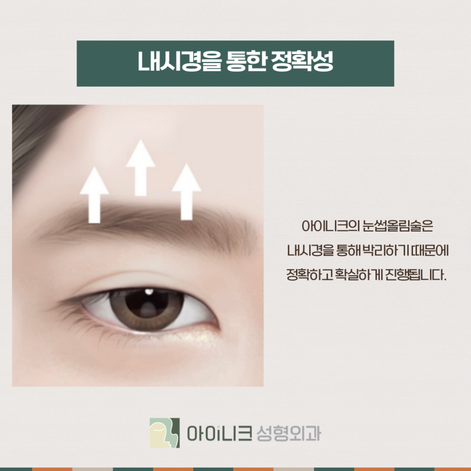 효과 좋은 눈썹올림술 찾고 있다면 관련 이미지 3