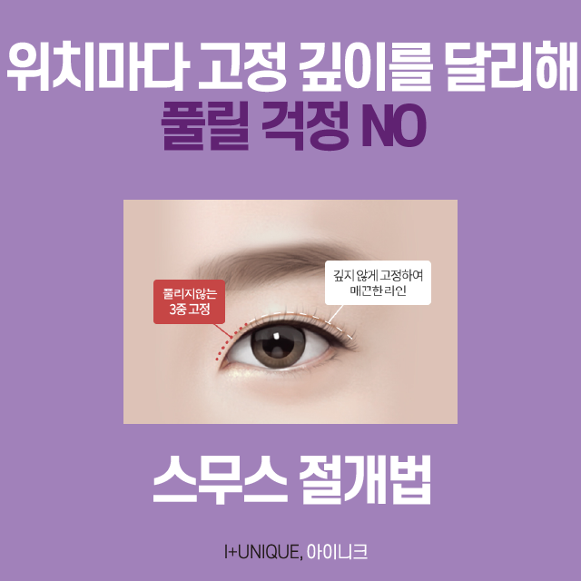 자연스러운쌍수를 위한 아이니크만의 솔루션 대공개 관련 이미지 4