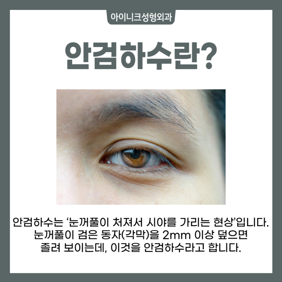 안검하수수술잘하는곳? 여기예요! 관련 이미지 2