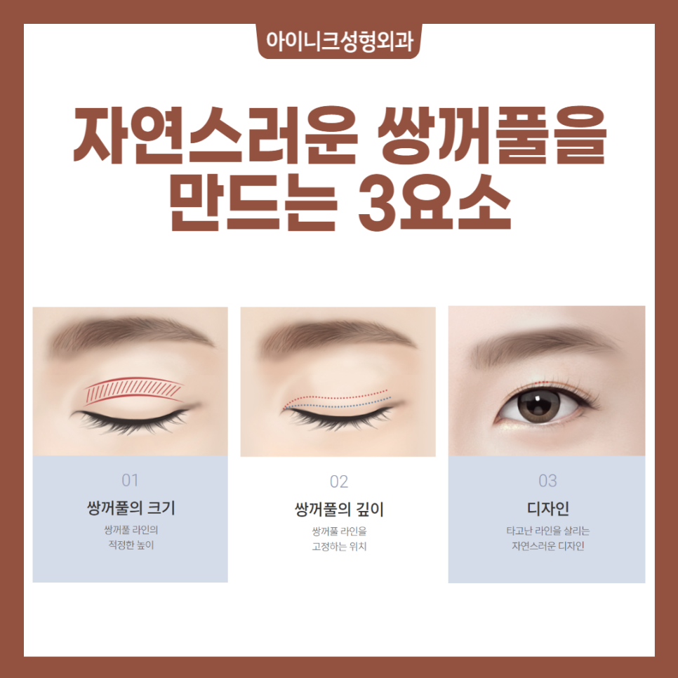 자연스러운눈성형 원한다면 미리 알아야 할 사실 관련 이미지 3