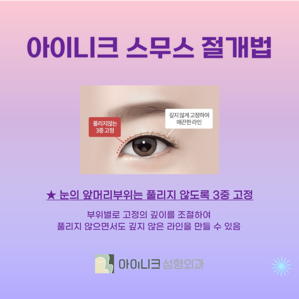 How Can You Make a Regret-Free Choice for Double Eyelid Surgery in Apgujeong? image 5
