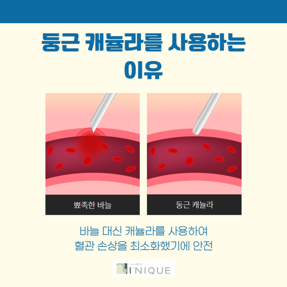 Do Fillers Require Anesthesia? image 5