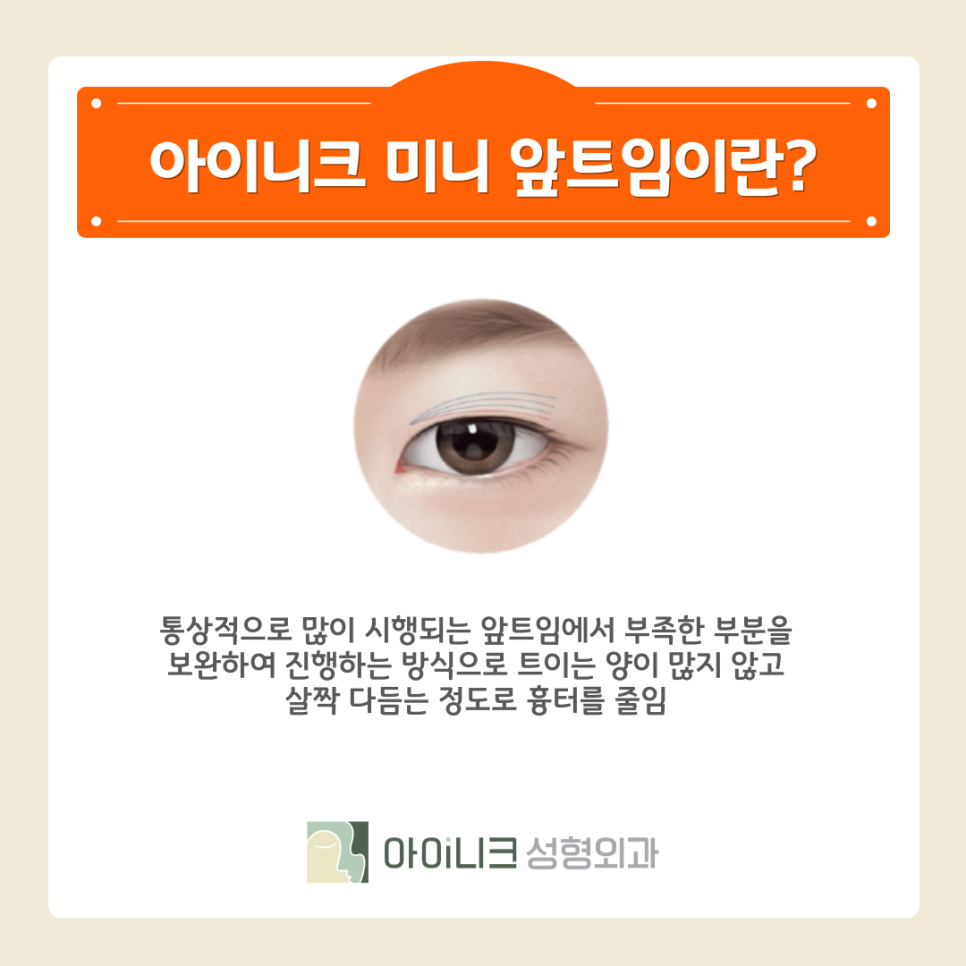 눈꼬리올리기 또렷하고 자연스러운 눈으로 관련 이미지 8