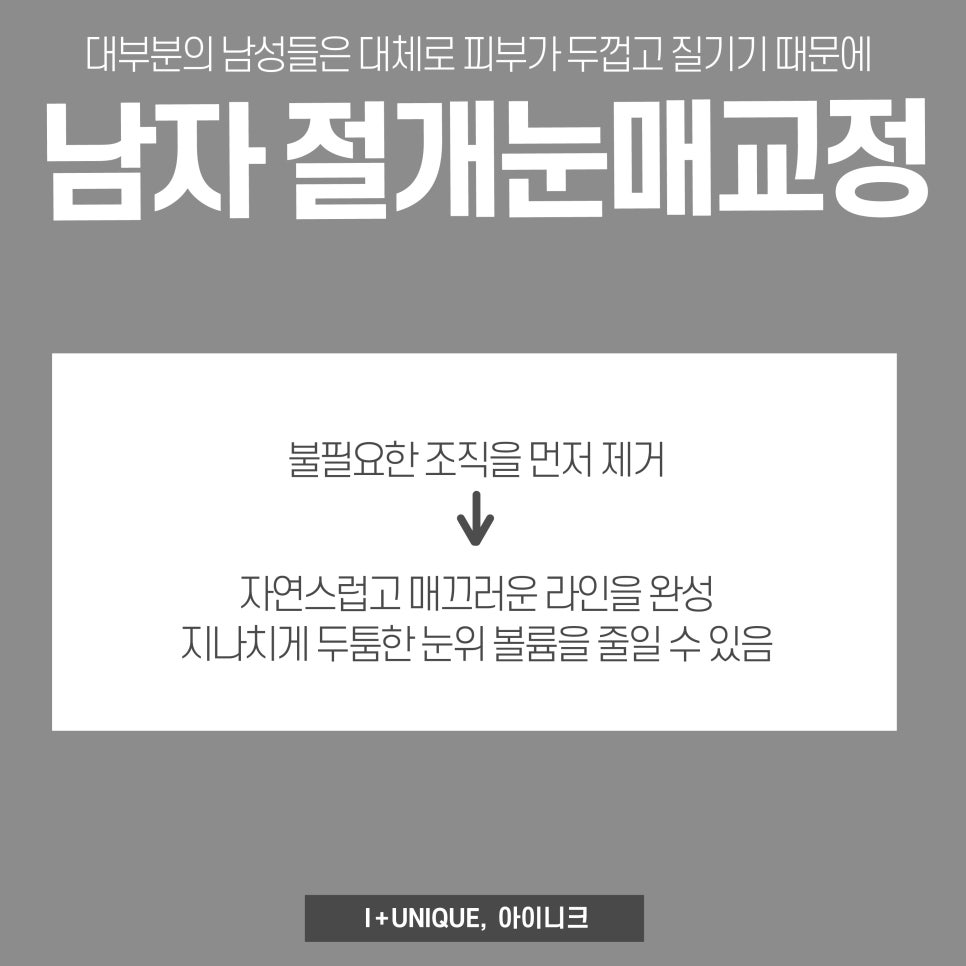 남자눈 성형 매몰? 절개? 적절한 방법 선택해야 자연스러운 쌍꺼풀라인 가능 관련 이미지 3
