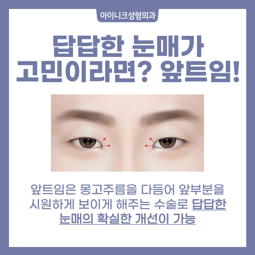 Full Eye Corners, Various Types! image 4