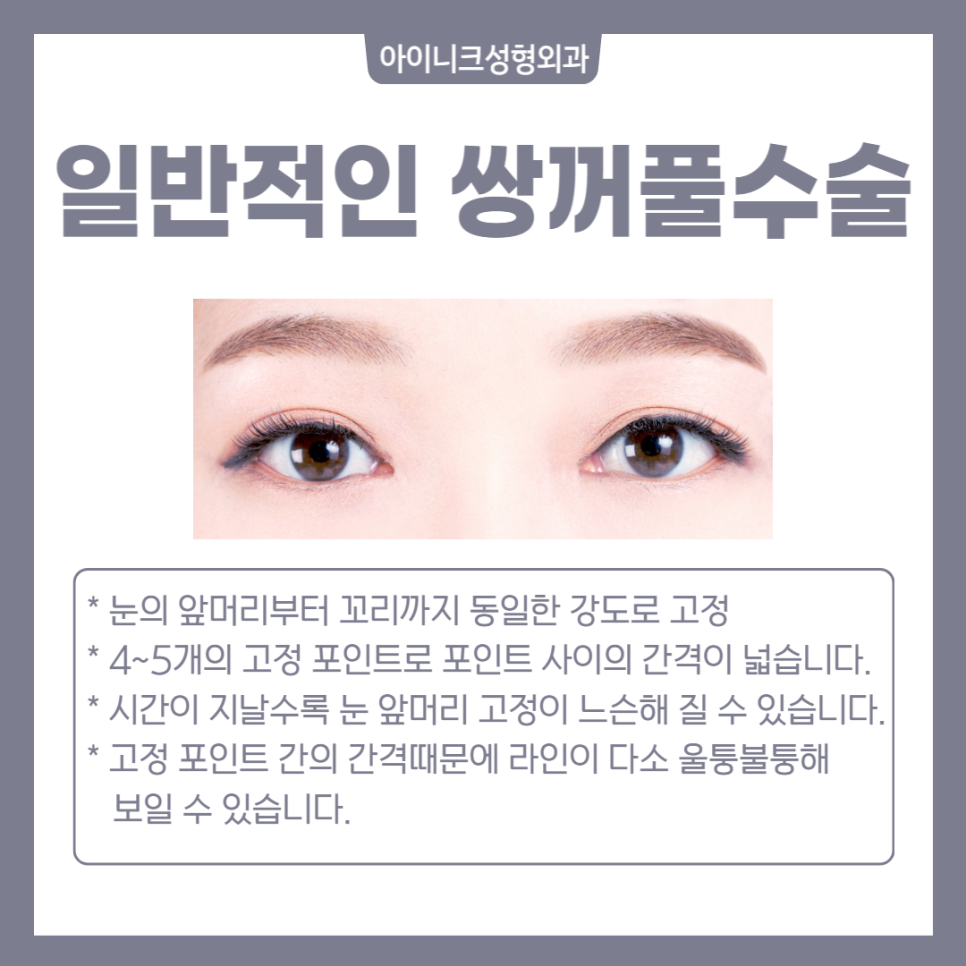 What Makes a Great Double Eyelid Surgery Clinic in Seoul Different! image 4