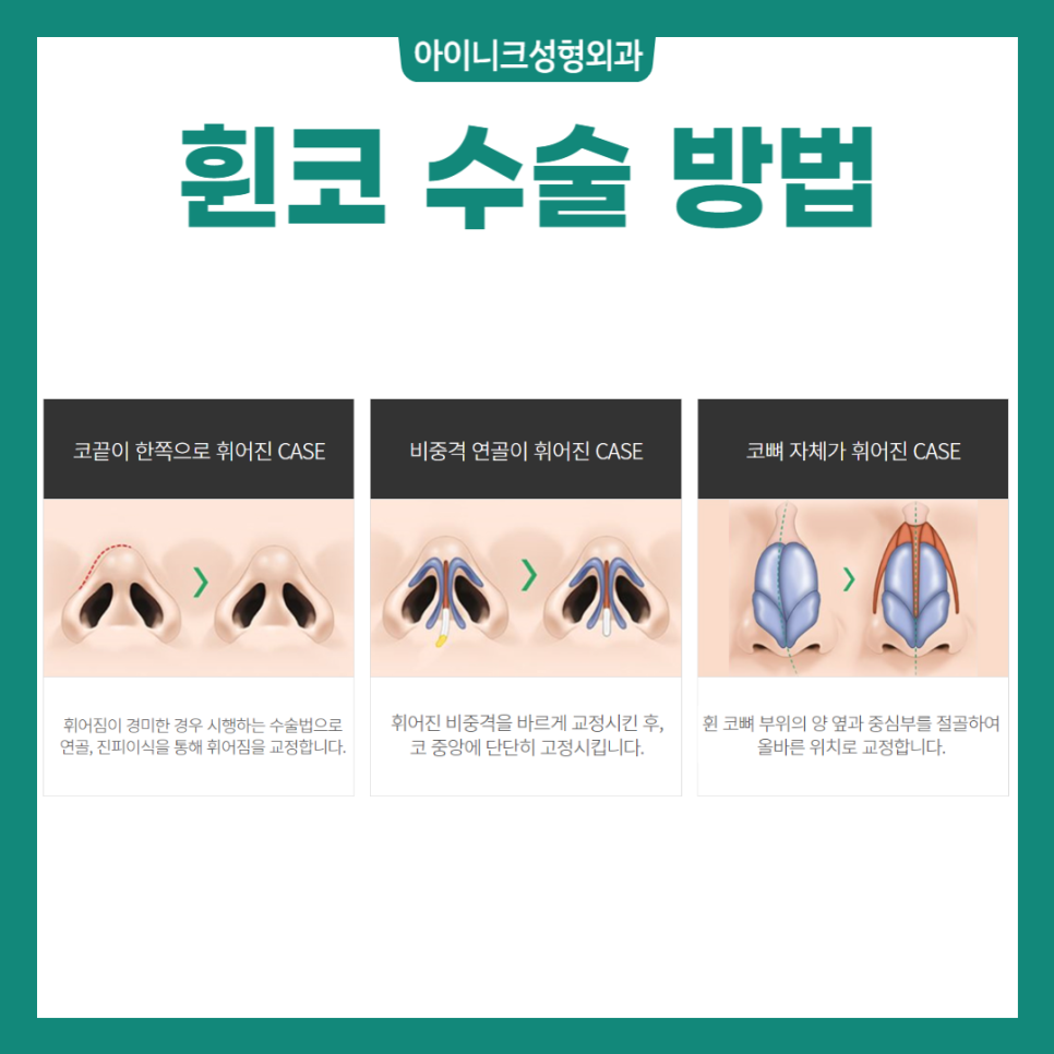남자코수술전후 효과 확실하게 볼 수 있는 방법 관련 이미지 3