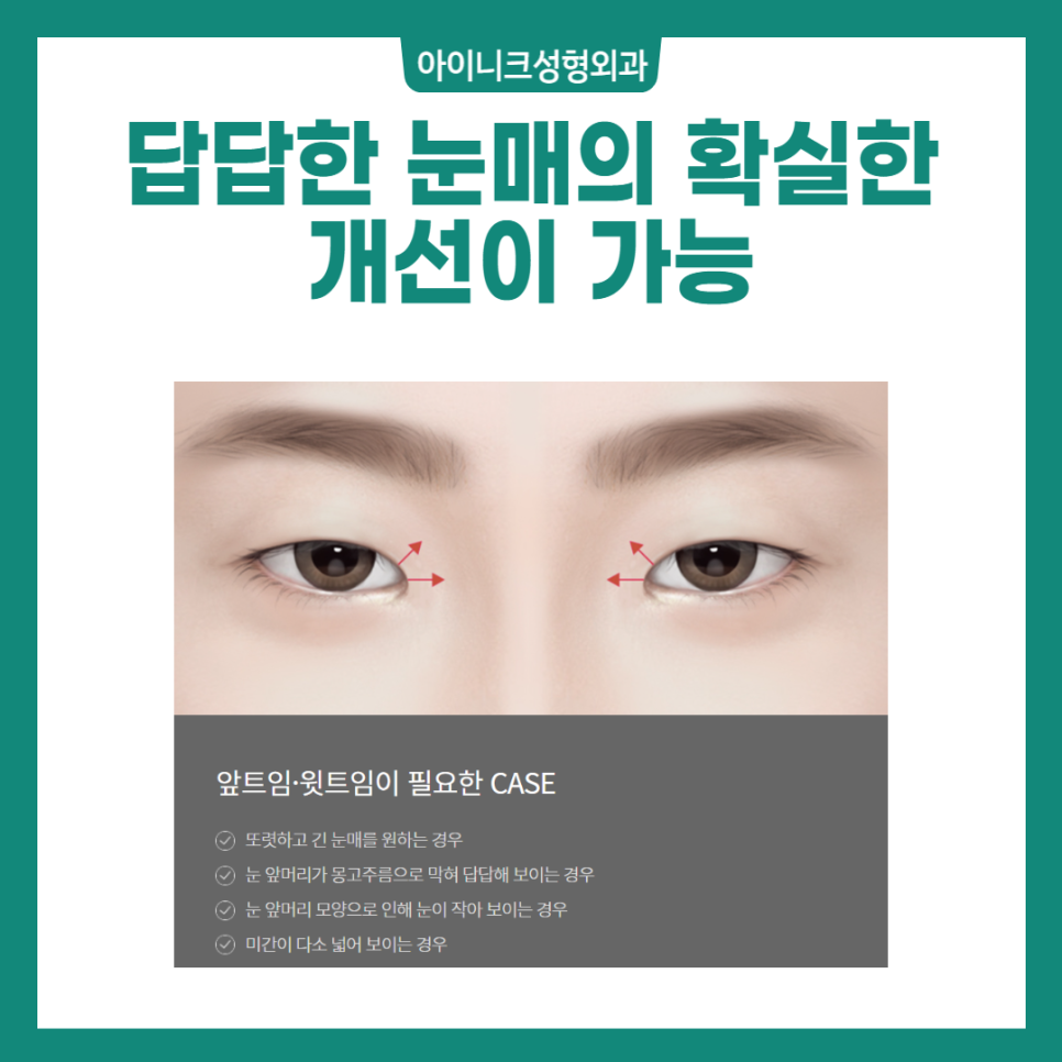 Various Canthoplasty Procedures: Which Design Suits Me Best? image 5