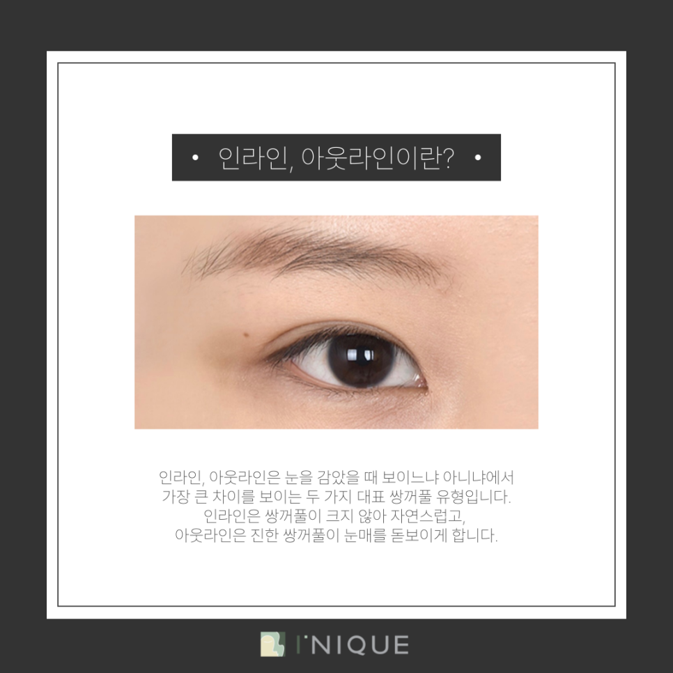 Gangnam Female Eye Surgery: How to Find the Line That Suits You image 3