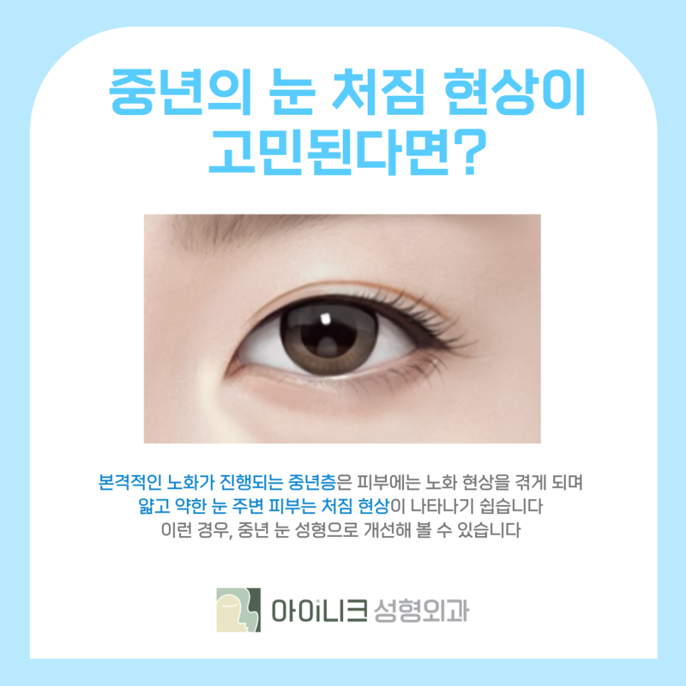 눈가리프팅 중년 눈성형으로 10년 어려보이기 관련 이미지 5