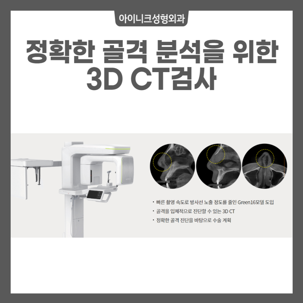 코성형잘하는성형외과의 콧볼 축소 수술 방법 관련 이미지 3