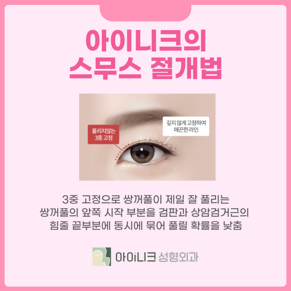 Blepharoplasty Clinic Tailored to Me in Different Ways! image 4