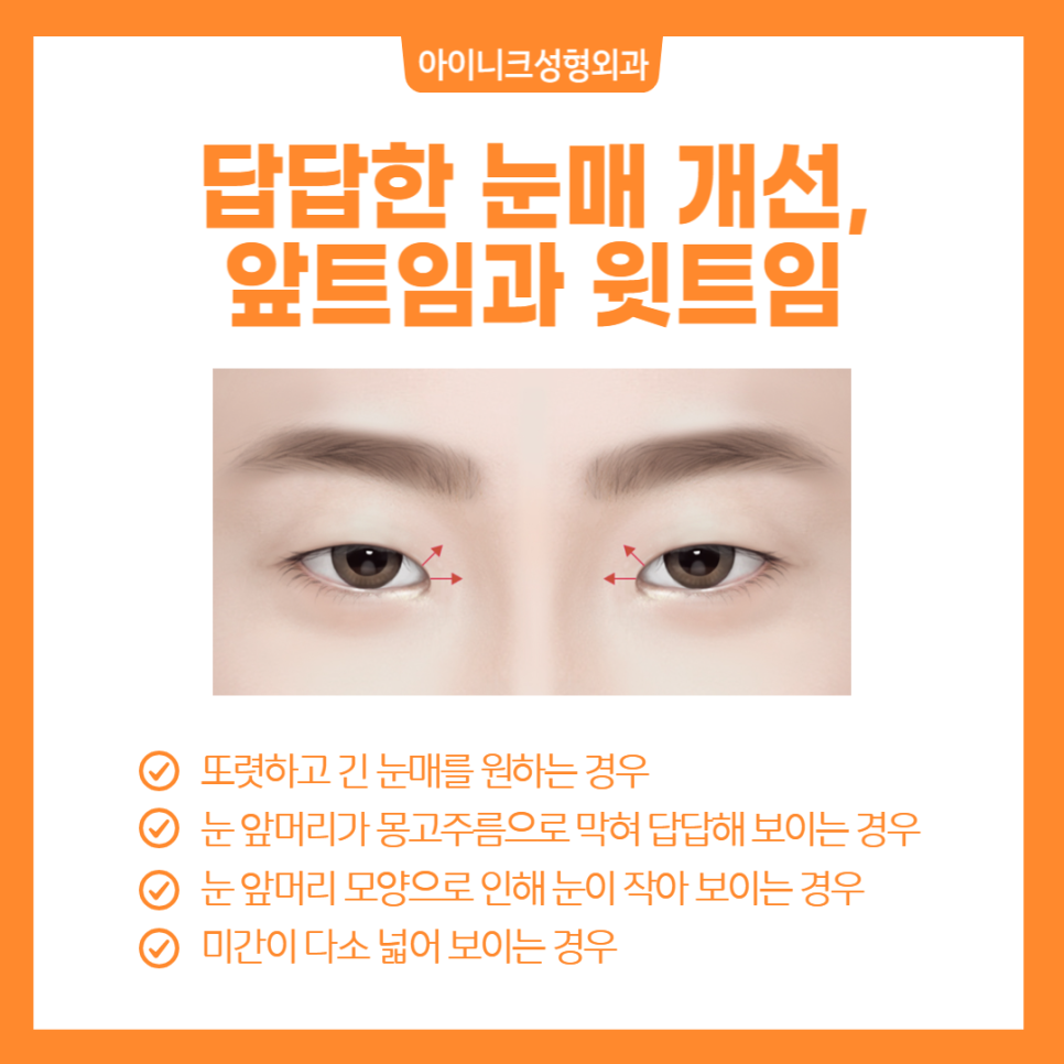 눈트임수술, 내 눈에 딱 맞게 선택하세요 관련 이미지 4