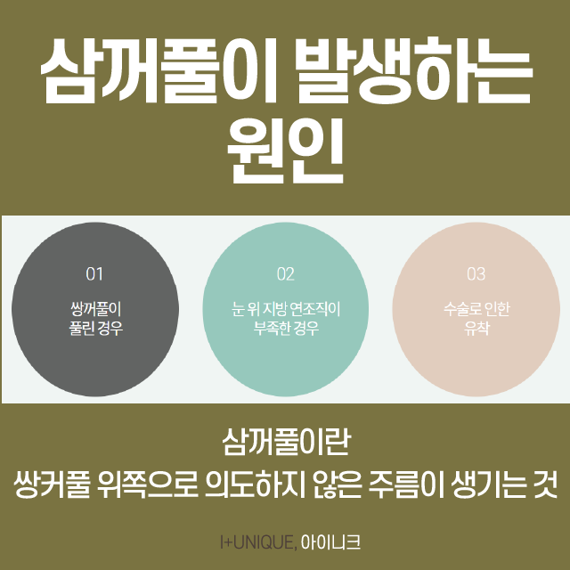 삼꺼풀해결방법, 원인 파악부터 제대로! 관련 이미지 2