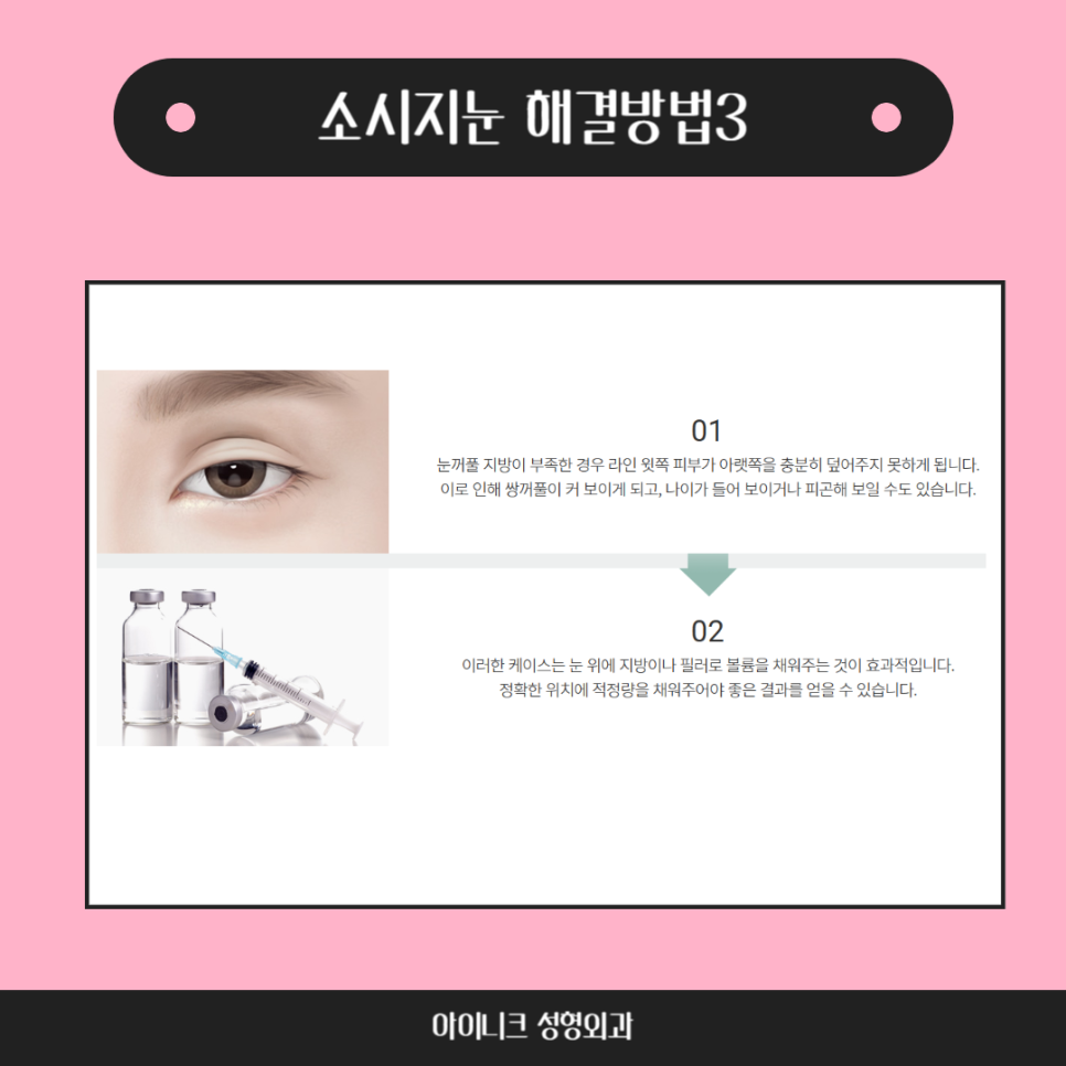 쌍꺼풀재수술병원, 실패없는 재수술을 위해 관련 이미지 5