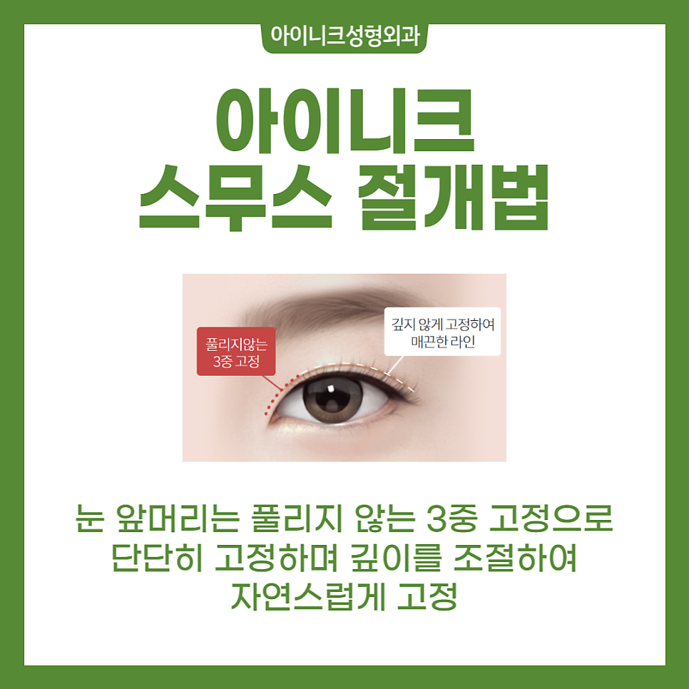 Double Eyelid Revision Surgery: You Need to Understand the Cause to Solve It! image 4